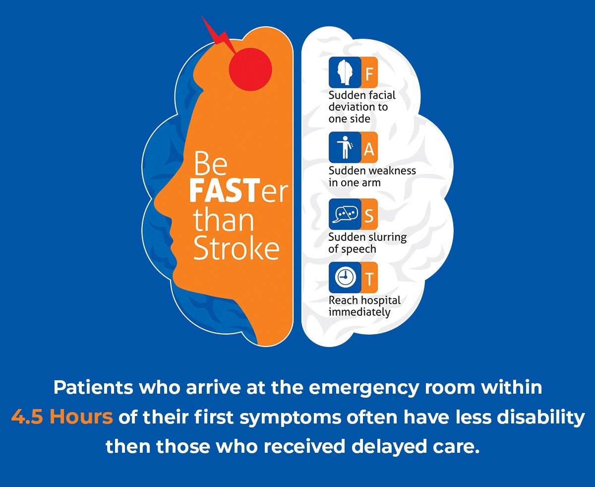 Brain Stroke Treatment