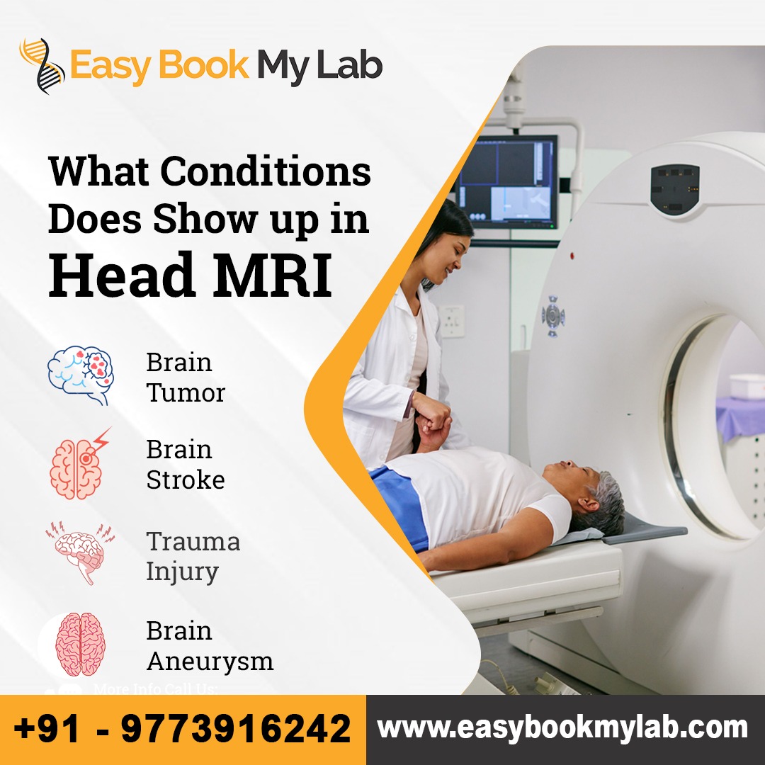 MRI Scan Cost In Bangalore Get Upto 50 Discount ct-scan-cost-in-bangalore-updated-list-with-discount-2024