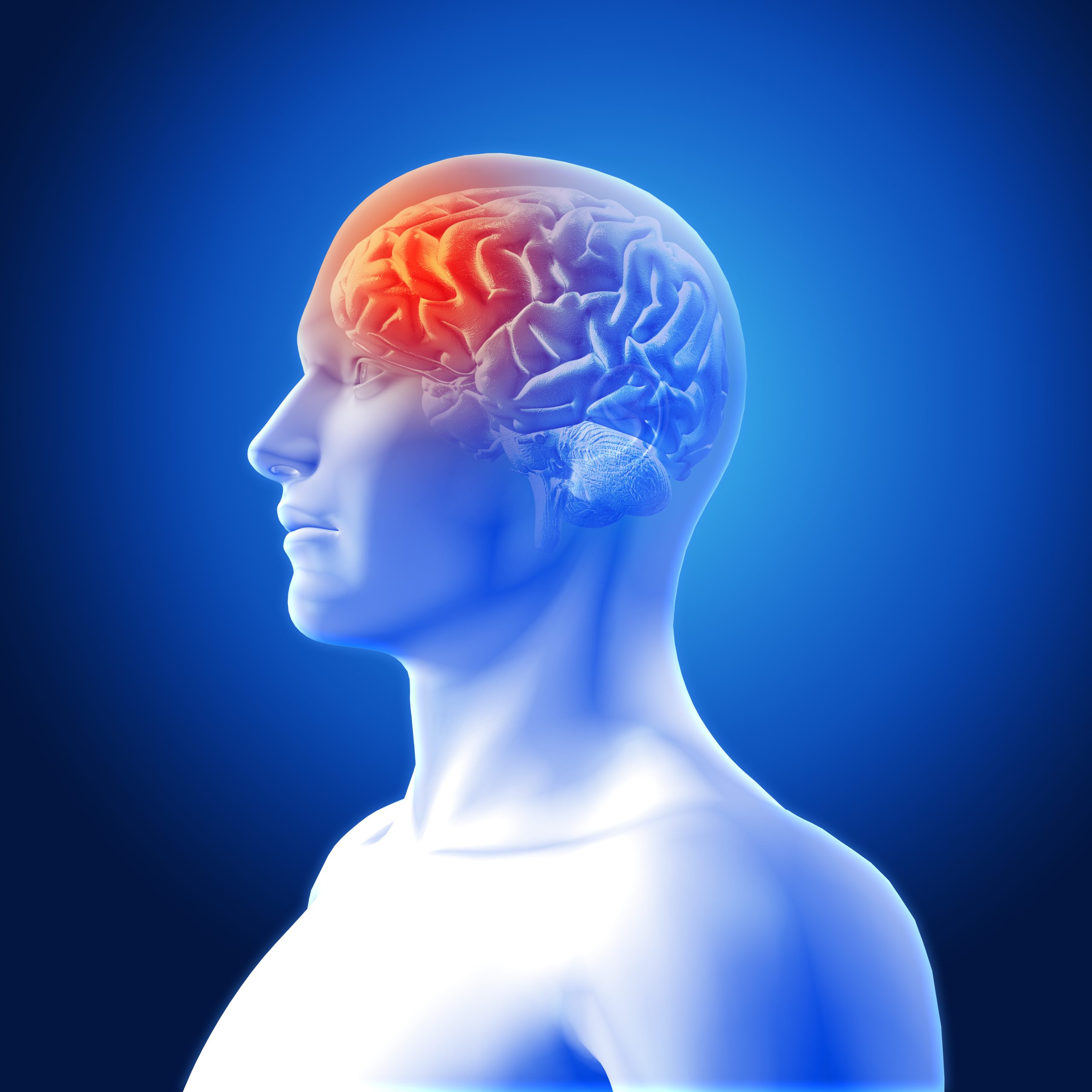 best neurologist in Delhi NCR