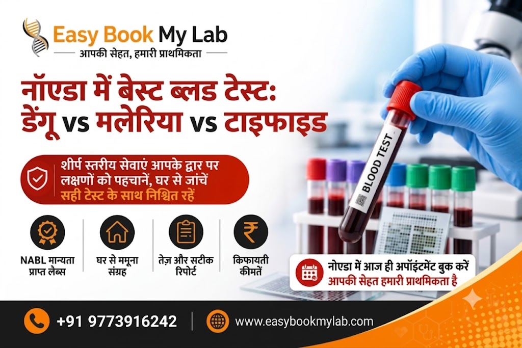 नॉएडा में बेस्ट ब्लड टेस्ट